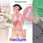 rectum meaning in hindi